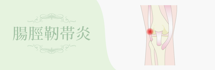 腸脛靭帯炎
